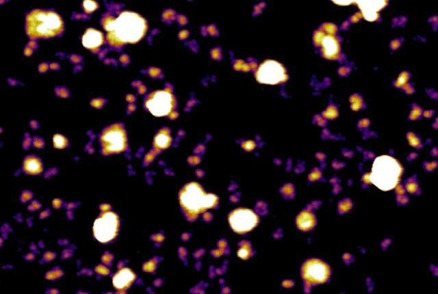 exosome 1